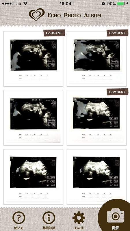 エコー写真をアルバムとアプリで保存 エコーフォトアルバム をweb