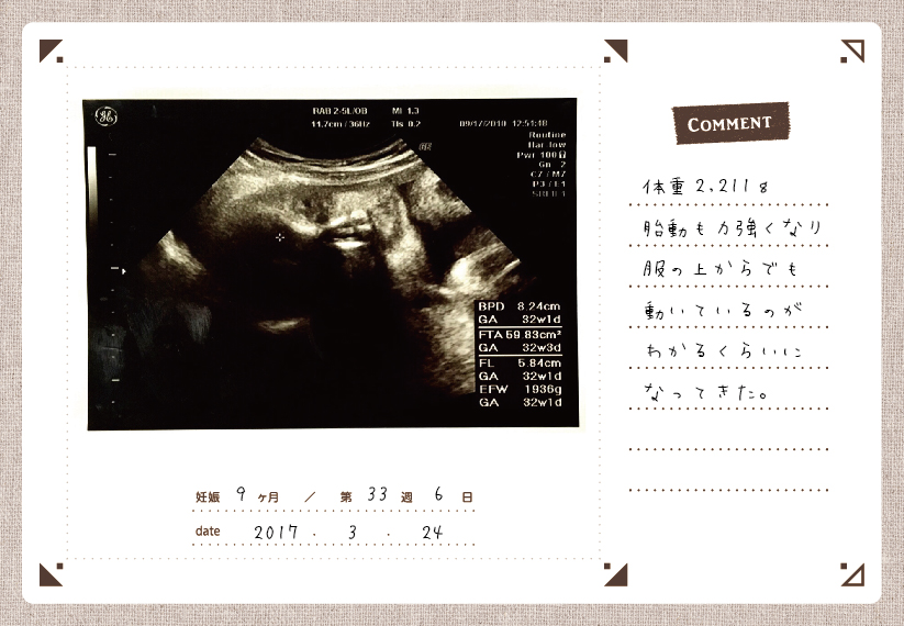 エコー写真をアルバムとアプリで保存 エコーフォトアルバム をweb販売開始 ニュース詳細 ナカバヤシ株式会社 アルバム 製本 シュレッダー 情報整理の総合サポーター